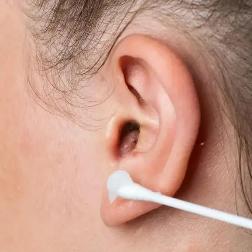 Comment accélérer la guérison des trous d'oreille après un perçage